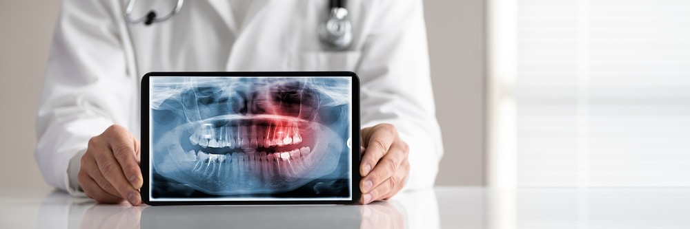 Radiologie dentară Brăila