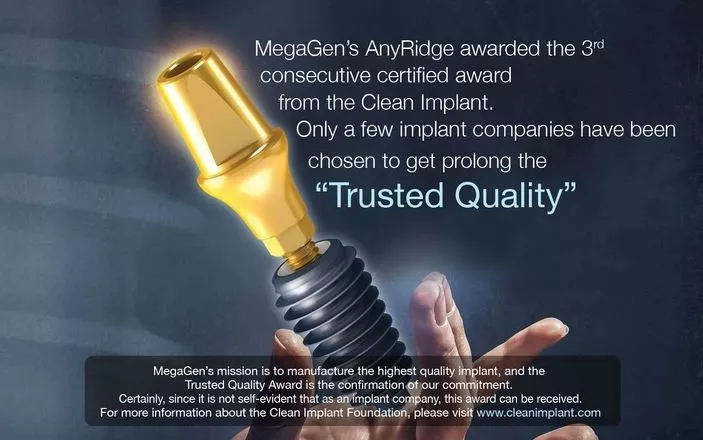 Cele Mai Performante Implanturi Dentare2