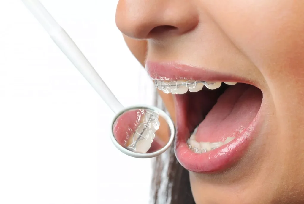 Ortodonție Brăila2