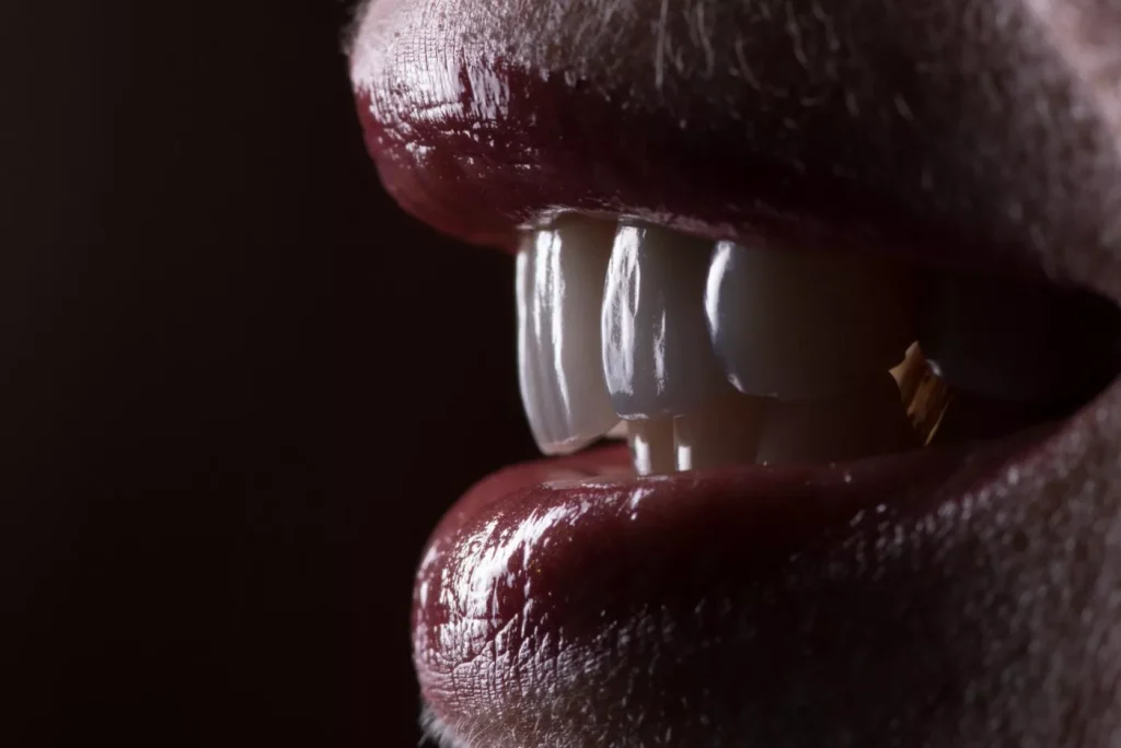 Articol Coroane Ceramice E MAX 3