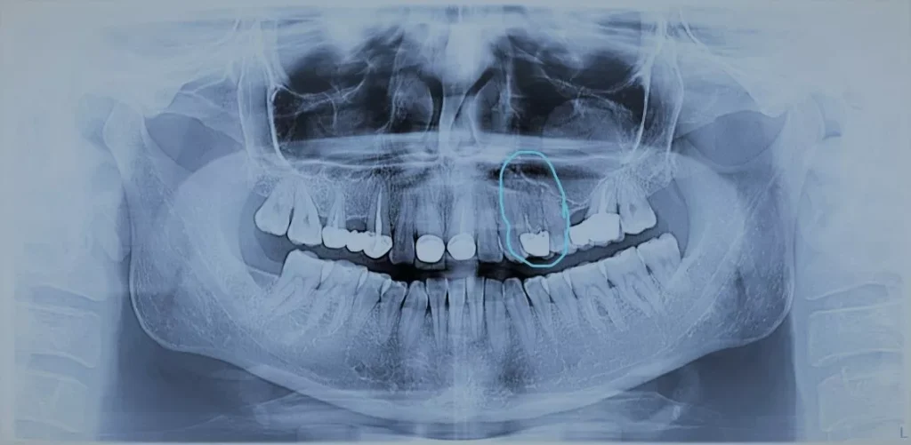 Articol Investigații Dentare 3D Sau 2D Diferențe și Avantaje 2