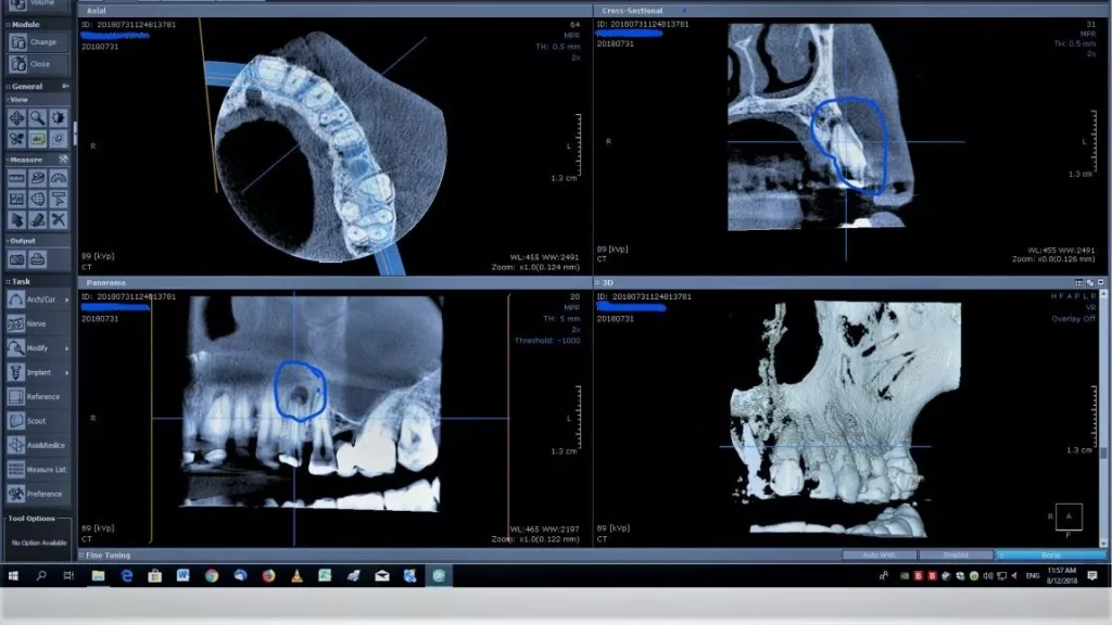 Articol Investigații Dentare 3D Sau 2D Diferențe și Avantaje 3