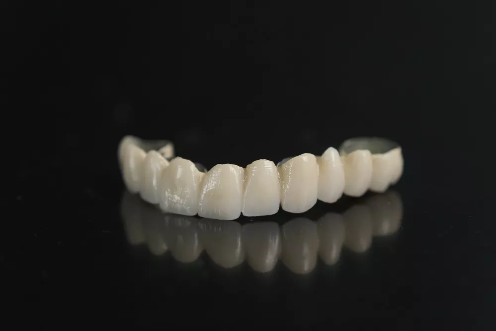 Va Ganditi La Tratamentul Cu Punti Dentare Iata Ce Trebuie Sa Aflati1 6926c0f0345ac