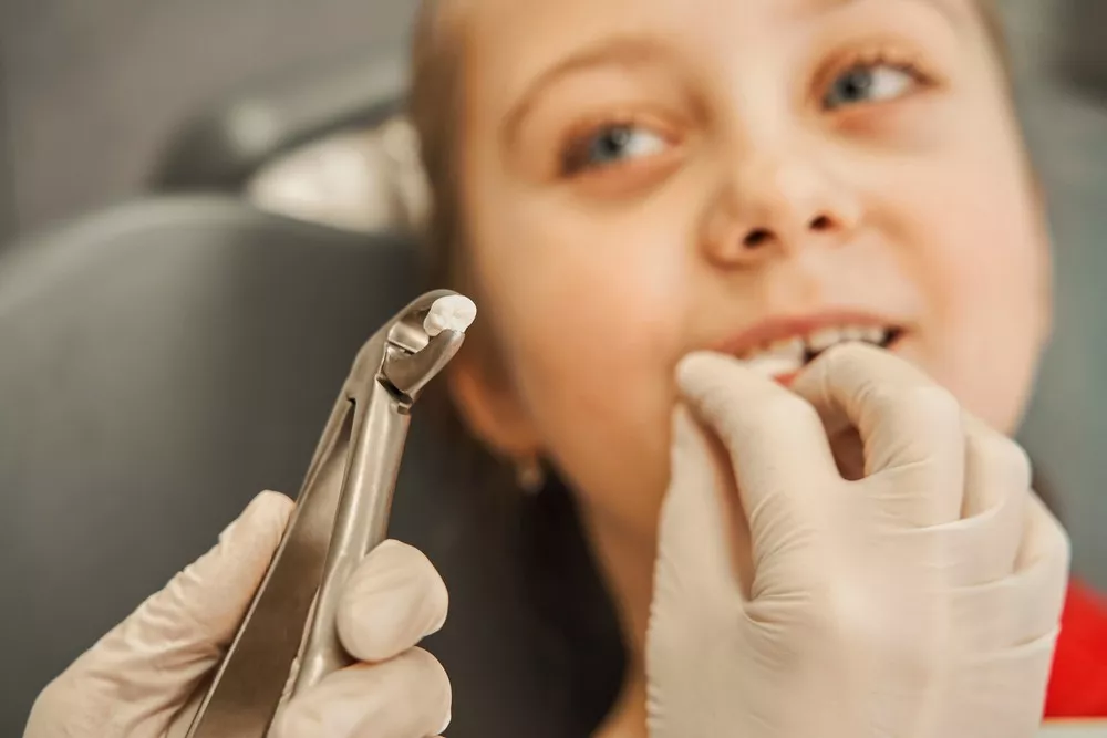 Ce Trebuie Sa Fac Dupa O Extractie Dentara Pentru O Vindecare Rapida 69b11d760e0c9