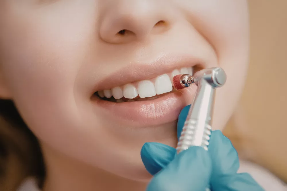 Estetica Dentara In Braila Optiuni Moderne Cu Grija Pentru Pacient 69b2760b76f83